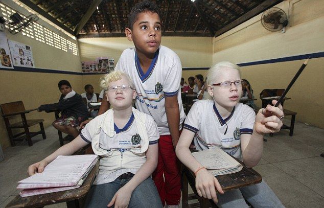 Бразильская мамаша родила тройню альбиносов