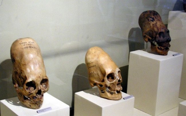 Красота требует жертв: 10 исторических примеров деформации черепов древними людьми