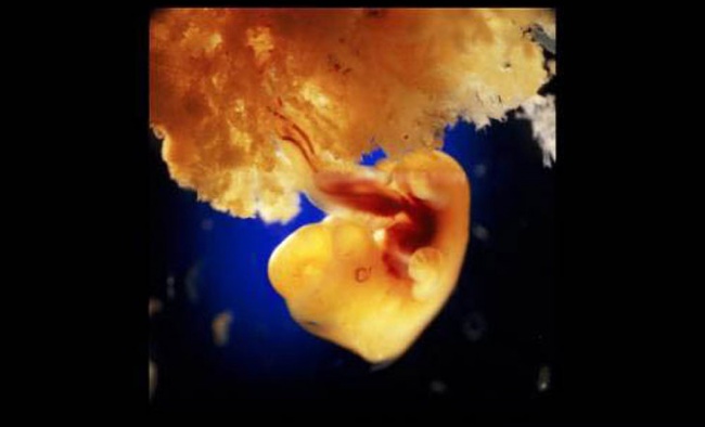 Начало жизни: от зачатия до рождения