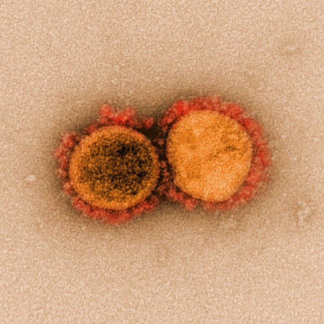 Фотографии коронавируса